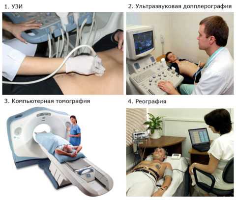 Методы диагностики варикозного расширения вен яичка и семенного канатика Методы диагностики варикозного расширения вен яичка и семенного канатика