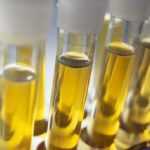 Моча не такая желтая, как обычно