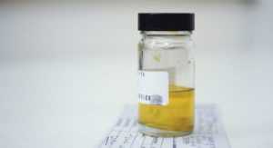 Почему моча пахнет ацетоном