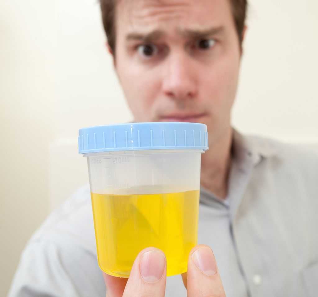 Что такое кетонурия