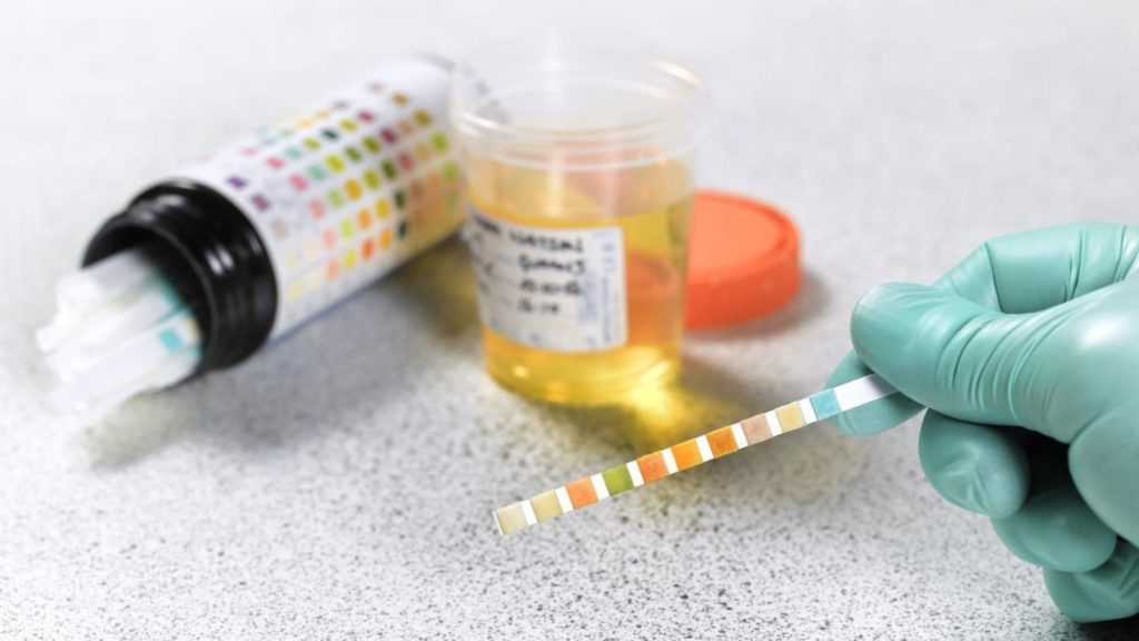 Ацетоном пахнет моча ребенка