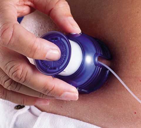 Модели подобных устройств могут различаться в зависимости от вида катетера. Модели подобных устройств могут различаться в зависимости от вида катетера.