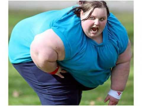 Морбидное ожирение у женщин Морбидное ожирение у женщин