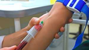 Признаки повышенного сахара в крови у мужчин