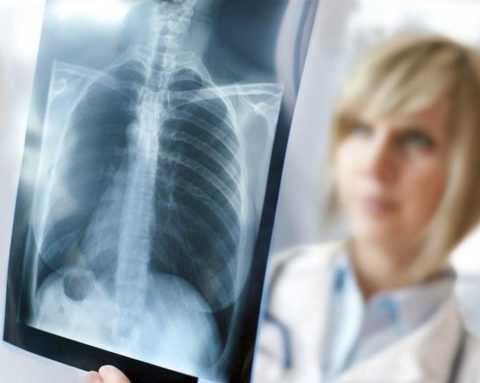 На фото флюорография