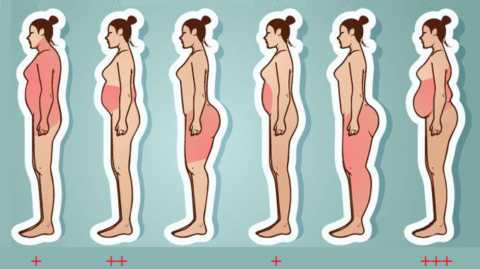 На риск развития СД2 и его течение влияют не столько лишние кг жира, сколько область их скопления