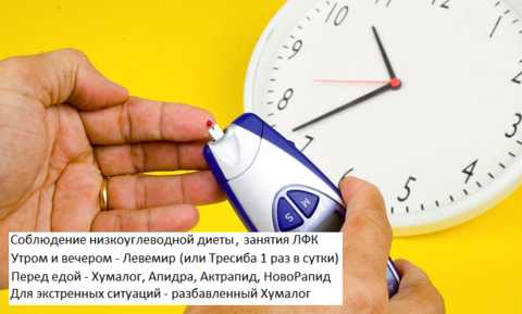 Наиболее эффективная схема контроля глюкозы в плазме крови при СД1 Наиболее эффективная схема контроля глюкозы в плазме крови при СД1