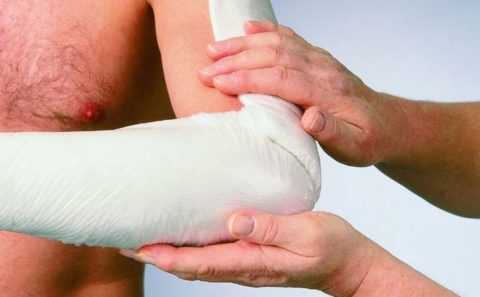 Наибольшую опасность представляют открытые переломы из-за риска инфицирования.