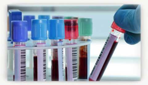 Но при этом нужно помнить, что снижение инсулина — это не показатель развития диабета Но при этом нужно помнить, что снижение инсулина — это не показатель развития диабета