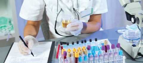 Общий анализ мочи