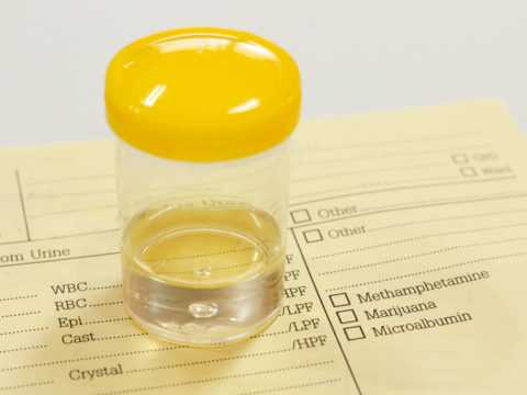 Общий анализ мочи