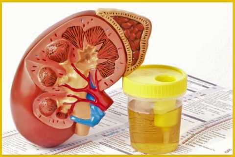 Один из основных первичных признаков СД – это полиурия (обильное выделение мочи)