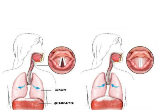 возникновение икоты