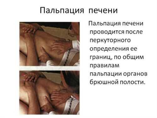 Пальпация печени