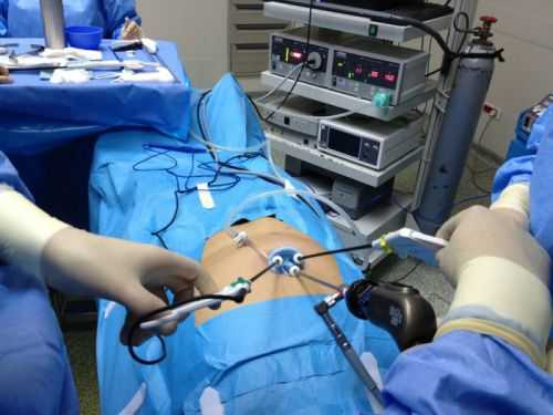 Лапароскопия