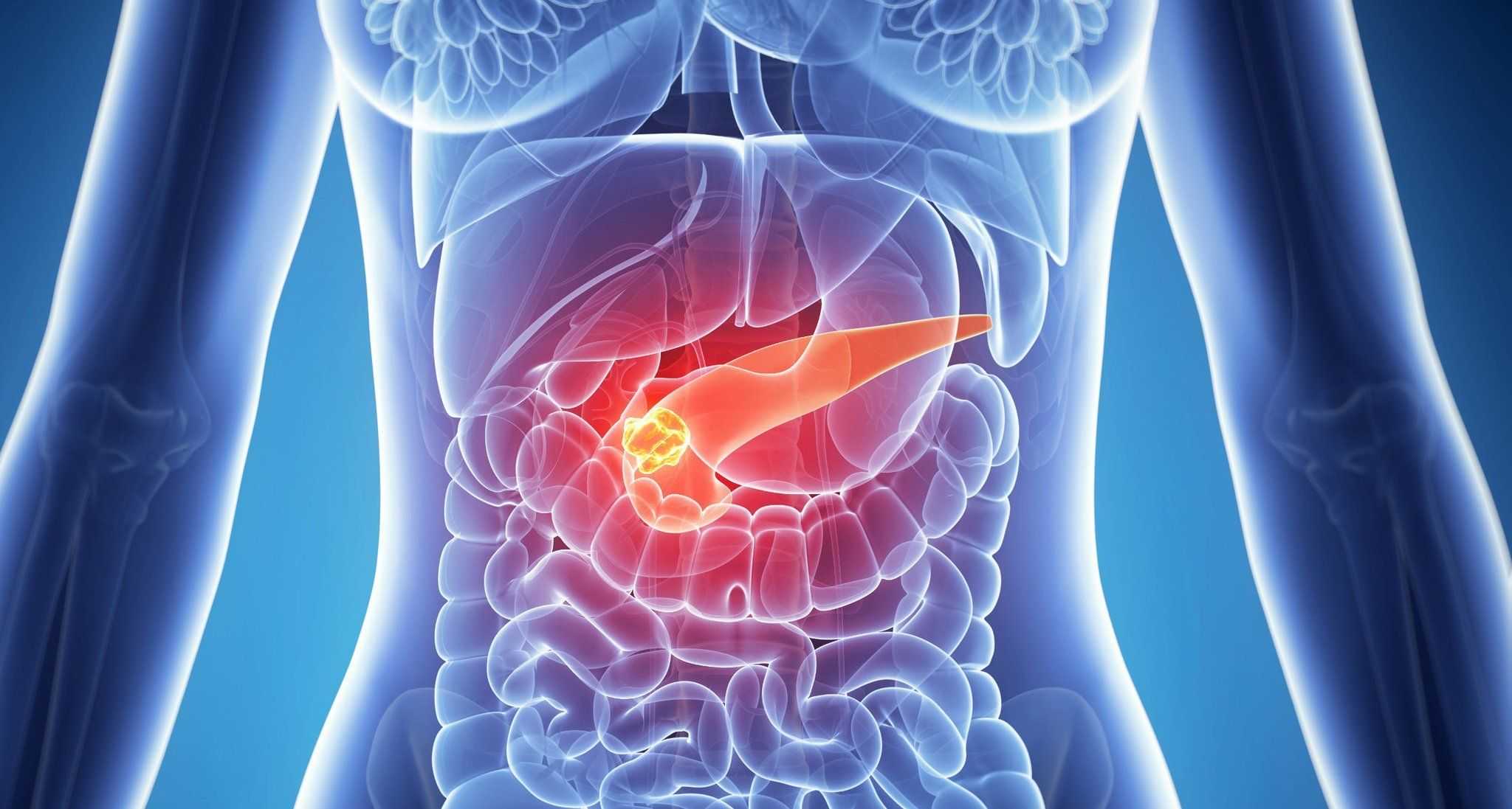 Побочные действия