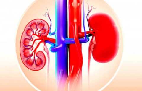 Патология почек, также частая причина выявления сахара в урине Патология почек, также частая причина выявления сахара в урине