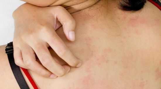 Зуд кожи и сыпь