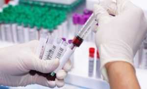 Глюкоза плазмы крови - норма, причины отклонений