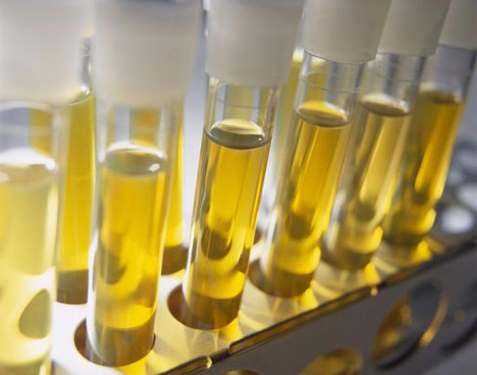 Почему образуется ацетон в урине.