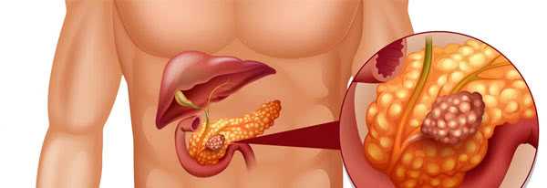 Поджелудочная железа при диабете