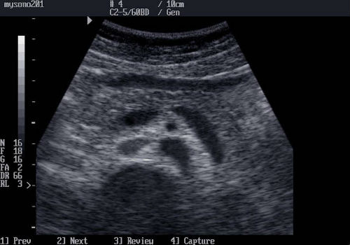 фотография узи