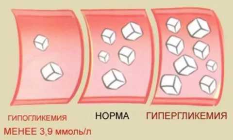 Показатели содержания сахара в крови Показатели содержания сахара в крови