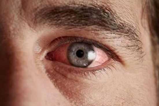 Красный глаз