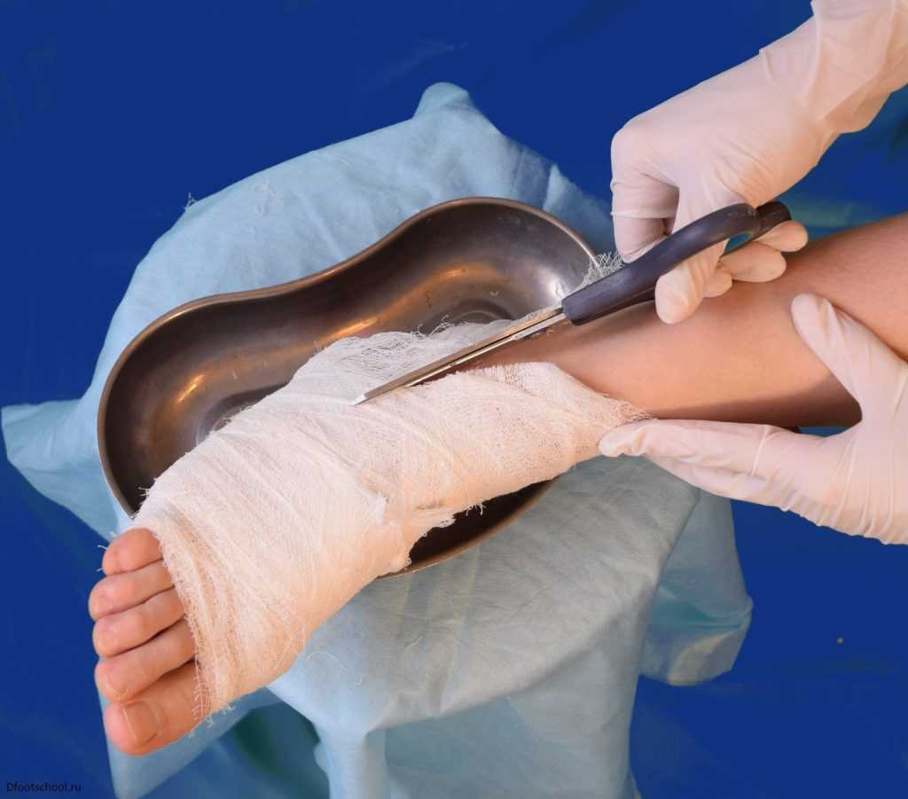 Действия при сахарном диабете