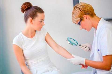 При наличии первых подозрений нужно обратится к дерматологу.