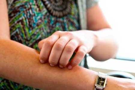 Причины развития диабетической дермопатии.