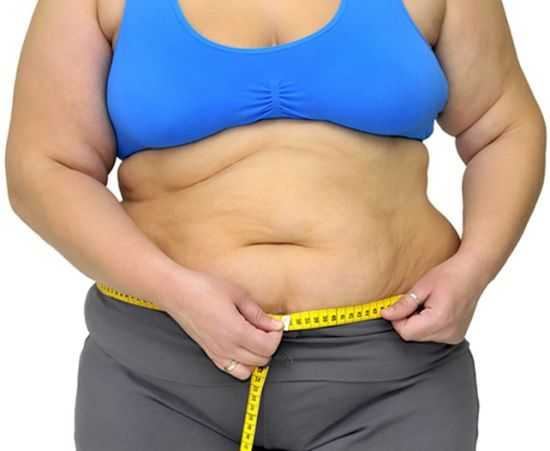 Ожирение у женщин