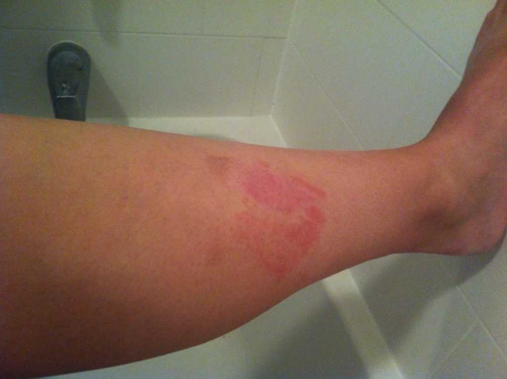 Места локализации