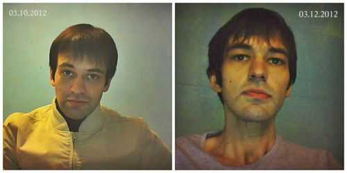 Пациент с раком поджелудочной железы