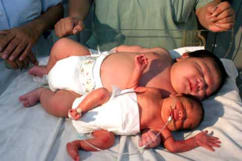 Рождение малыша весом больше 4 кг. Рождение малыша весом больше 4 кг.