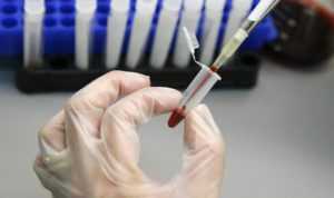 Норма сахара и холестерина в крови