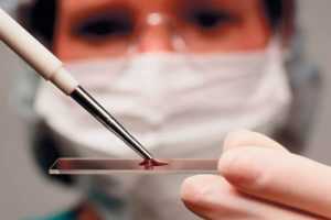 Анализ крови