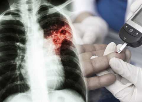 Само по себе сочетание не дает больному права на оформление группы Само по себе сочетание не дает больному права на оформление группы