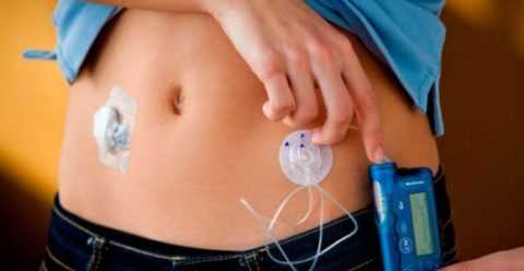 Система обеспечивает контроль за углеводным обменом.