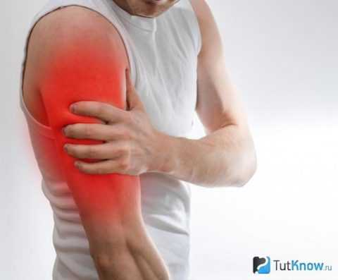 Слабость мышц.