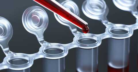 Специфические анализы крови – основа для уточнения диагноза Сахарный диабет Специфические анализы крови – основа для уточнения диагноза Сахарный диабет