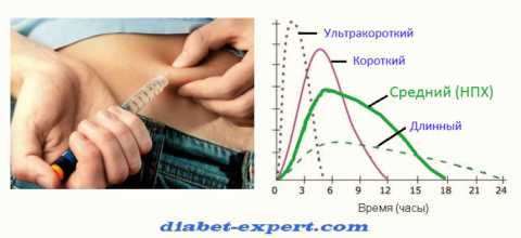 Сравнение времени действия инсулина разных видов Сравнение времени действия инсулина разных видов