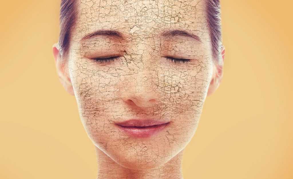 Сухость кожи