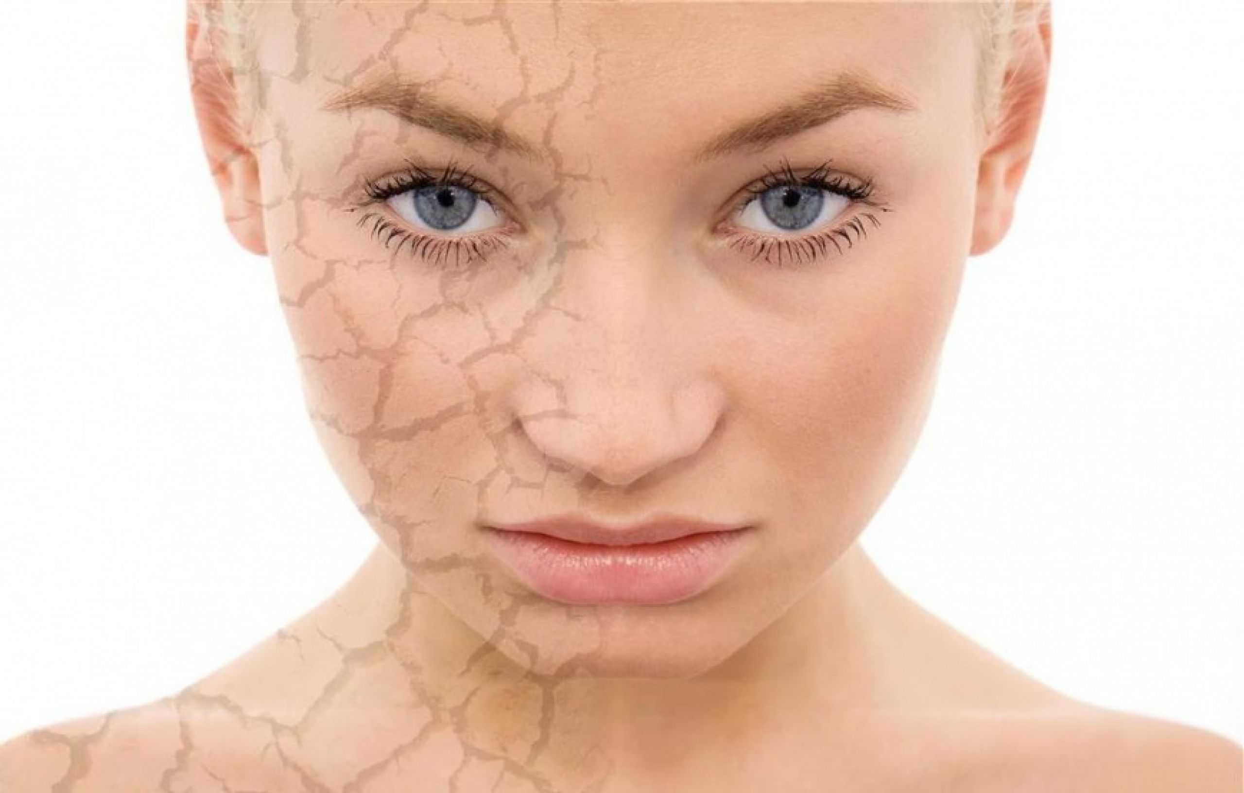 сухость кожи