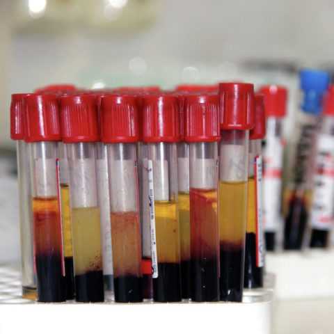 Сыворотка крови