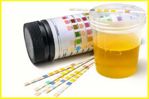 Тест-полоски помогут определить наличие сахара в моче, не выходя из дома Тест-полоски помогут определить наличие сахара в моче, не выходя из дома