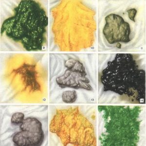 цвет кала при патологиях