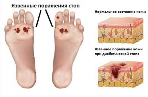 Тяжелая и тяжело поддающаяся лечению патология Тяжелая и тяжело поддающаяся лечению патология