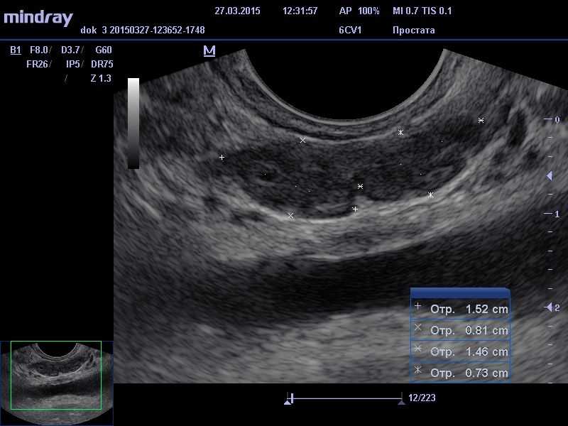 Диагностика