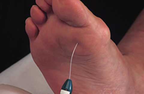 Ухудшение состояния кожного покрова.